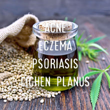 Load image into Gallery viewer, Rorephantom ~ full spectrum pain relief balm